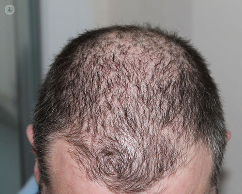 Hair Growth Spells That Work Fast